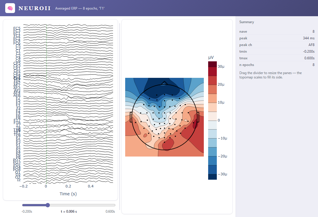 Averaged ERP viewer for the left-fist task: stacked channels, a scalp topomap, and a time slider