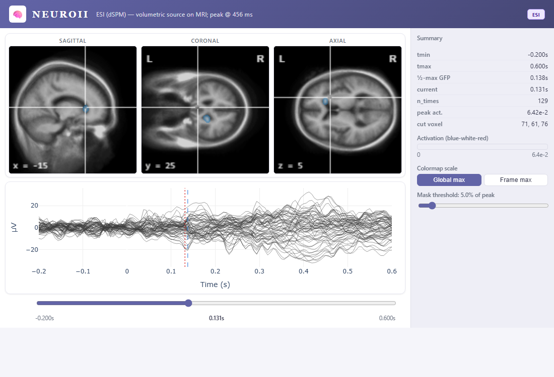 Source-imaging viewer showing three MRI slices with an activation overlay and an ERP butterfly plot