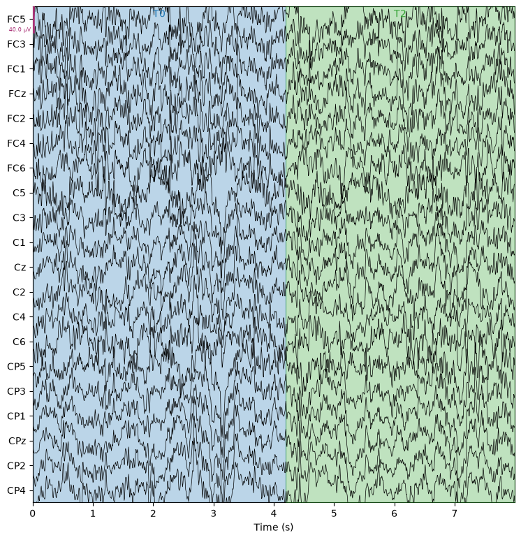 Raw EEG traces — 20 of 64 channels, with real recorded moments shaded in the background