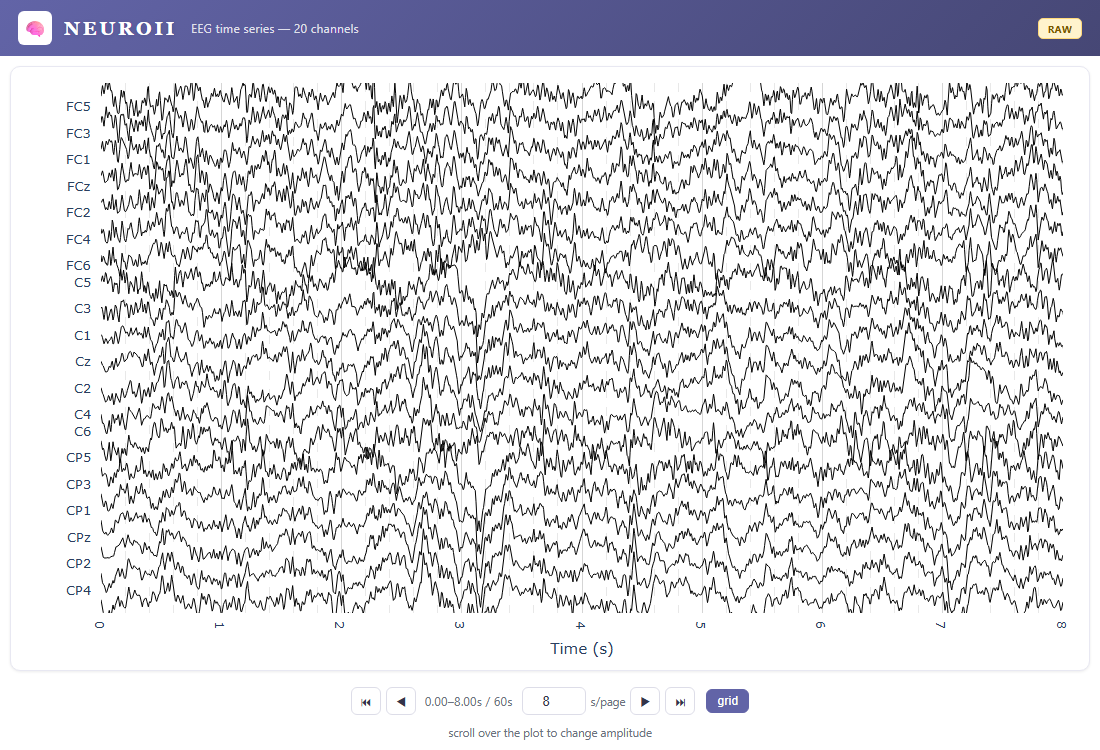 Interactive EEG time-series viewer with page navigation controls and 20 channels visible